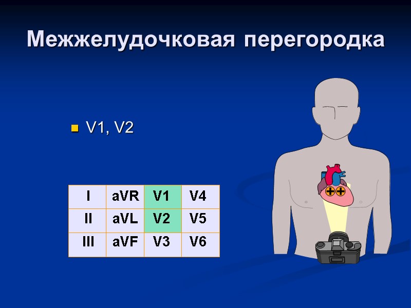 Межжелудочковая перегородка V1, V2 I II III aVR aVL aVF V1 V2 V3 V4